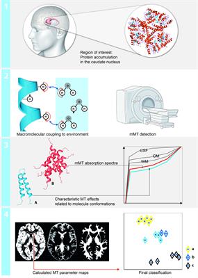 Model-Based Magnetization Transfer Imaging Markers to Characterize Patients and Asymptomatic Gene Carriers in Huntington’s Disease